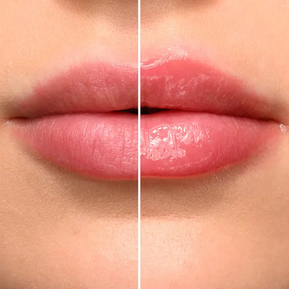 The Lip Plumper